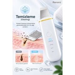 CONCORD SM-15 RENORA 4IN1 Ultrasonic Cilt Temizleme
